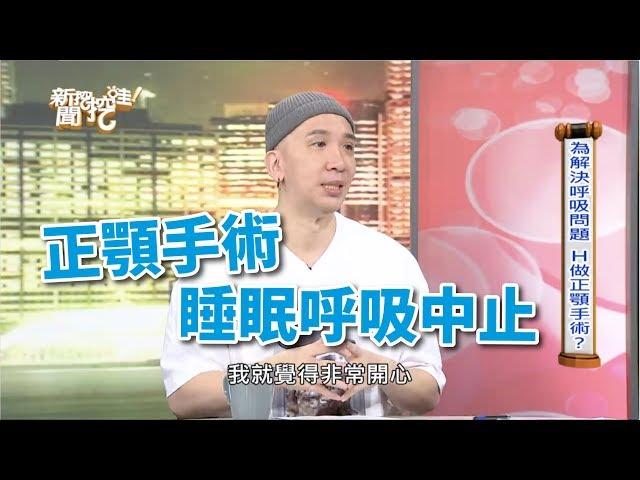 正顎手術治療睡眠呼吸中止-謝明吉醫師案例分享