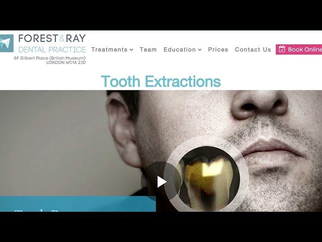 Tooth Extraction W1 Holborn Camden London - Forest & Ray - Dentists, Orthodontists, Implant Surgeons