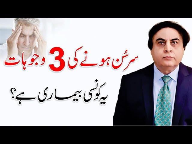 Dimag Sunn kyu hota hai? Brain Weakness Symptoms | By Dr. Khalid Jamil