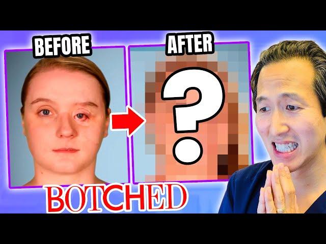 Plastic Surgeon Reacts to BOTCHED: Incredible Eye Reconstruction!