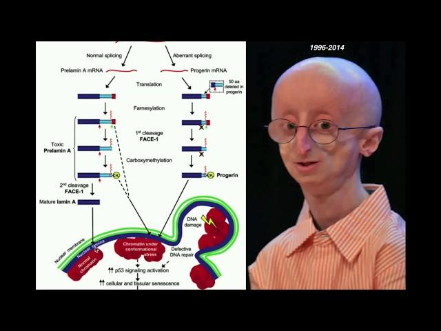 Progeria, Accelerated Aging | Biochemical Mechanism of Progeria
