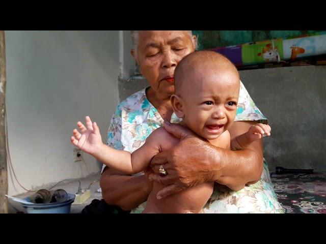 Bayi malang ini sakit dan dibawa kedukun pijat tradisional