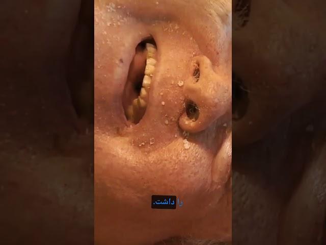 پل الکساندر مردی که زندگی اش الهام بخش همه ی ماست#اطلاعات #معلومات_عمومی #دانستنی #اگاهی