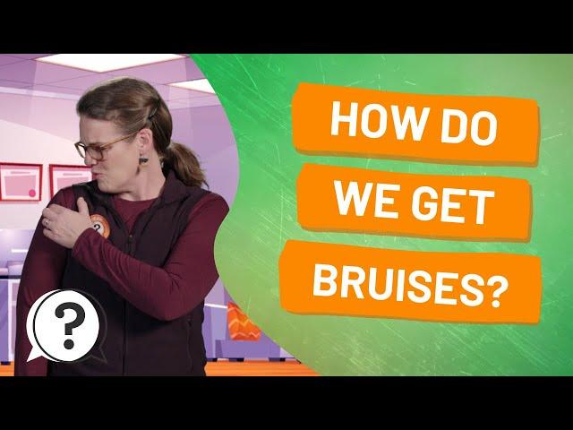 How do we get bruises? | But Why Bites