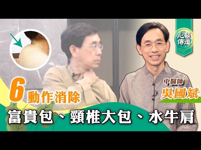 【醫道心傳】手麻 胸悶 肩頸緊繃痠痛 頭暈頭痛 耳鳴 睡眠障礙 眼睛酸澀 都可能由富貴包引起 |吳國斌中醫師 |頸椎大包 水牛肩 保養歸位頸椎 改善駝背 增加進氧量 幫助睡眠 放鬆肩頸按摩|#綠色東方