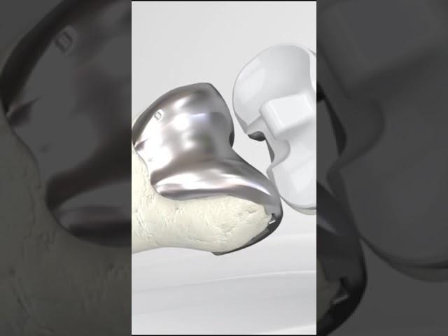 Centre for Robotic Joint Replacement at DECCAN HARDIKAR HOSPITAL - True Robotics | Dr. Saurabh Giri