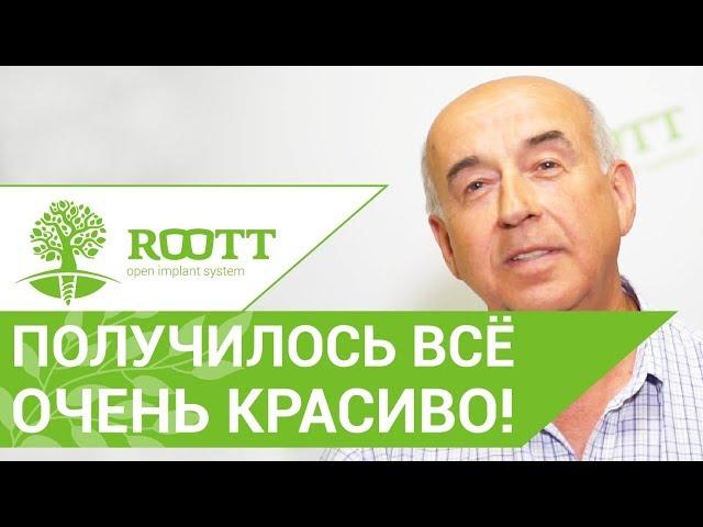   Отзыв пациента клиники ROOTT о полной имплантации всех зубов за 4 дня