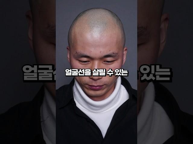 탈모때문에 빡쳐서 홧김에 '삭발'해버린 남자...