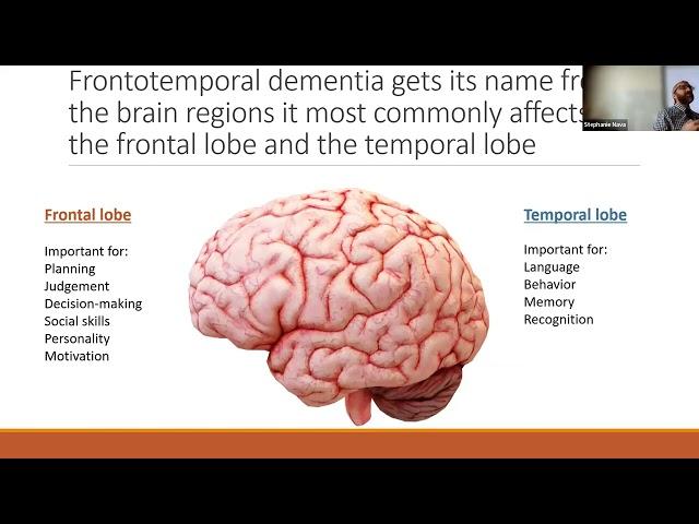 Frontotemporal Dementia: What we know and what we want to know