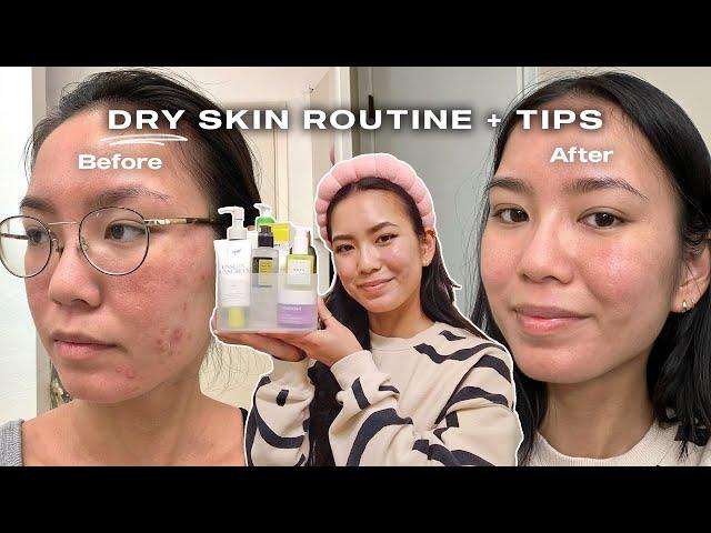 dry, sensitive, acne-prone skincare routine w/ tips (not sponsored)