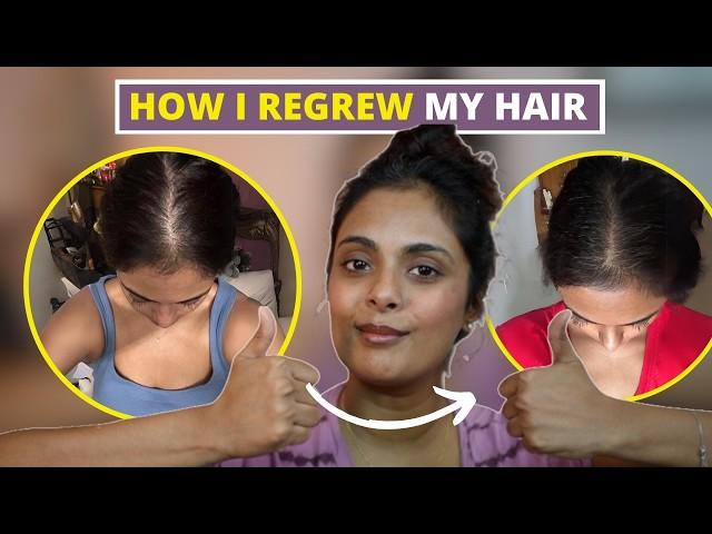 my hair loss journey and how I am growing it back