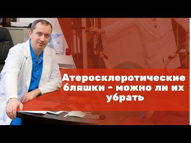 Атеросклеротические бляшки – можно ли их убрать?