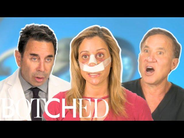 Dr. Nassif Transforms Norina's "Ski Lift" Nose FULL TRANSFORMATION | Botched | E!