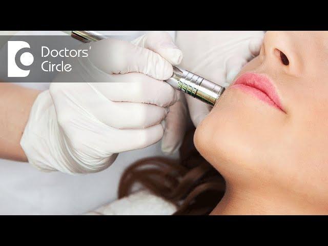 Will open pores shrink after Laser treatment? - Dr. Nischal K