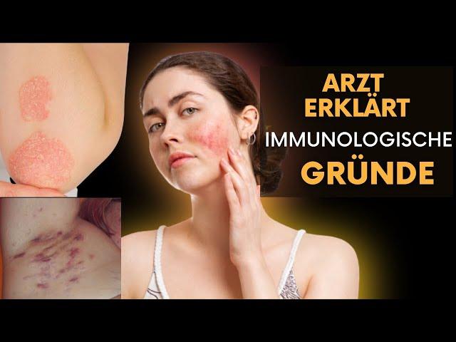 Autoimmunerkrankung! Entzündete Haut: Schnell zum Rheumatologen? Rheuma-Arzt erklärt!