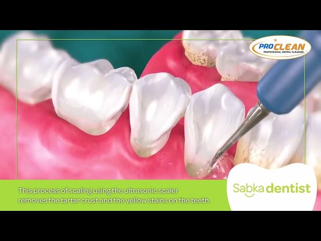 Teeth Cleaning + Polishing at Sabka Dentist | Combo Offer | ₹500/- only