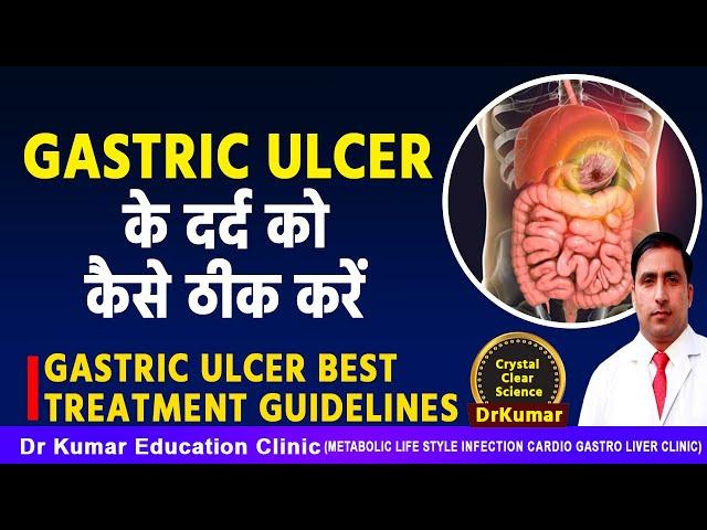 GASTRIC ULCER के दर्द को कैसे ठीक करें//GASTRIC ULCER BEST TREATMENT GUIDELINES