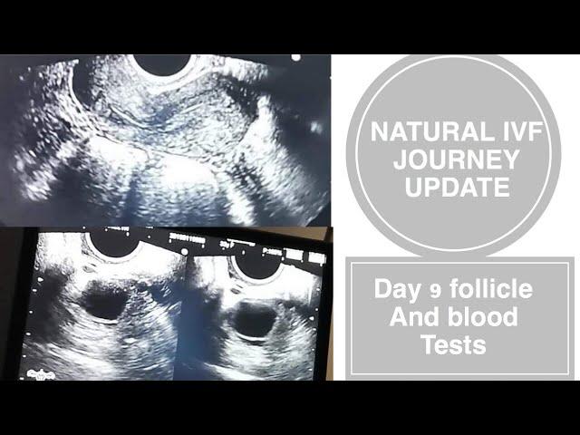 IVF journey: day 9 follicle scan and blood tests update | Kato repro biotech center