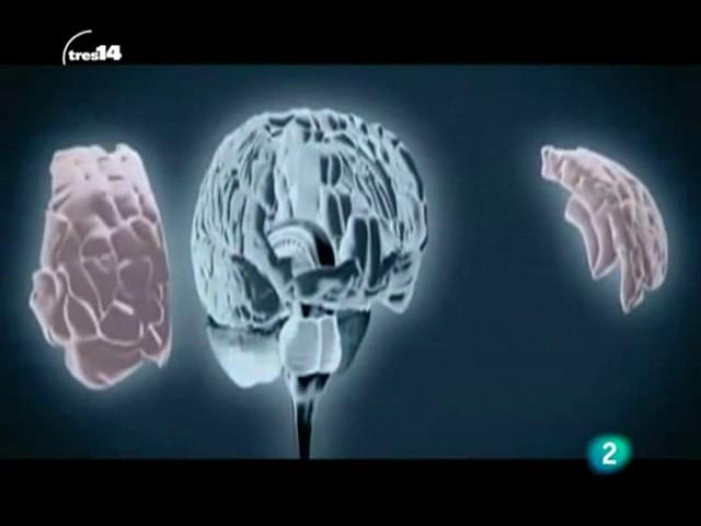 El cerebro hiperactivo