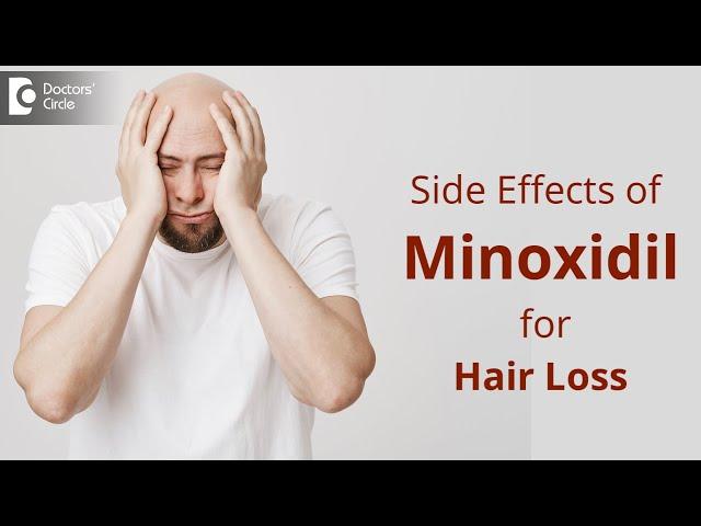 Side effects of Minoxidil for Hair Loss | TIPS to Deal This - Dr. Deepak P Devakar | Doctors' Circle