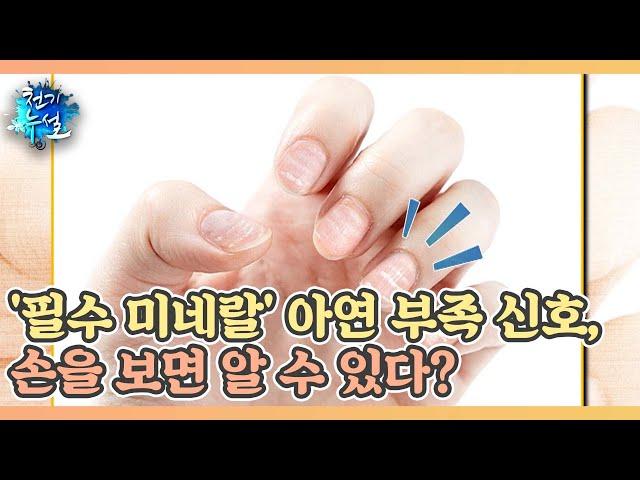 '필수 미네랄' 아연 부족 신호, 손을 보면 알 수 있다? MBN 220624 방송