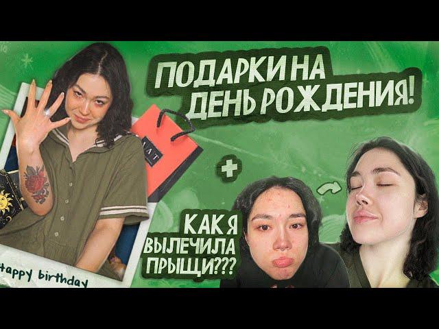 О НАБОЛЕВШЕМ | ЧТО ПОДАРИЛИ НА ДЕНЬ РОЖДЕНИЯ? КАК Я ВЫЛЕЧИЛА ПРЫЩИ