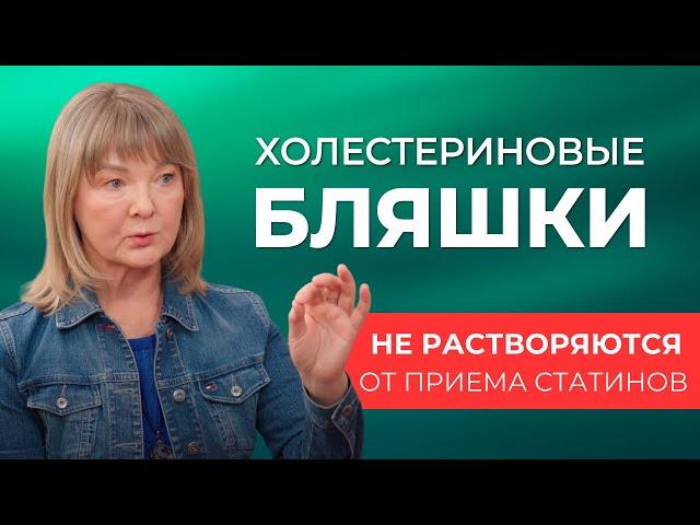 Почему врачи назначают статины? Правда, что от повышенного холестерина появляются бляшки в сосудах?