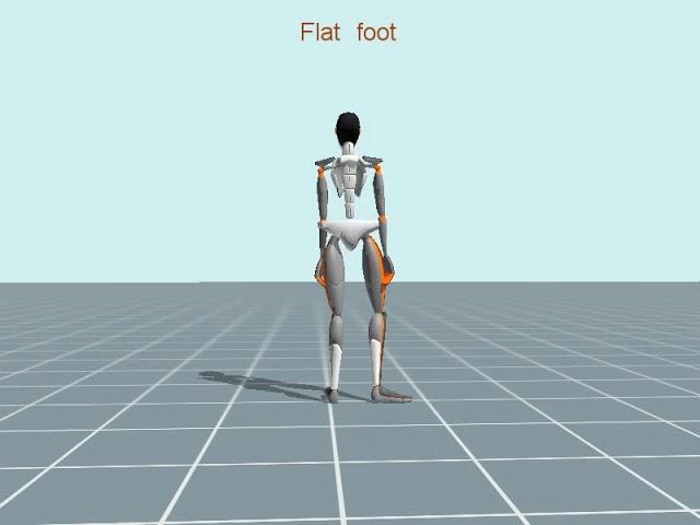 Flatfoot Walking