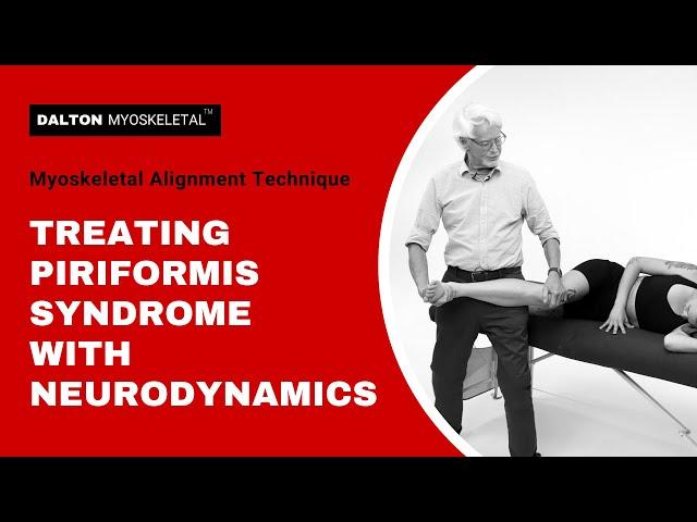 Treating Piriformis Syndrome with Neurodynamics | ErikDalton.com