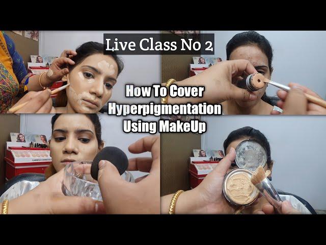 How I cover Dark Circles, Spots & Pigmentation || Lashes Beauty Parlour