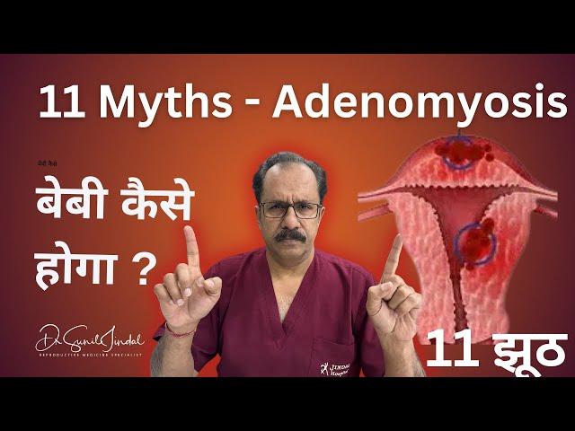 Adenomyosis MYTHS vs. FACTS You Need to Know|Dr.Sunil Jindal