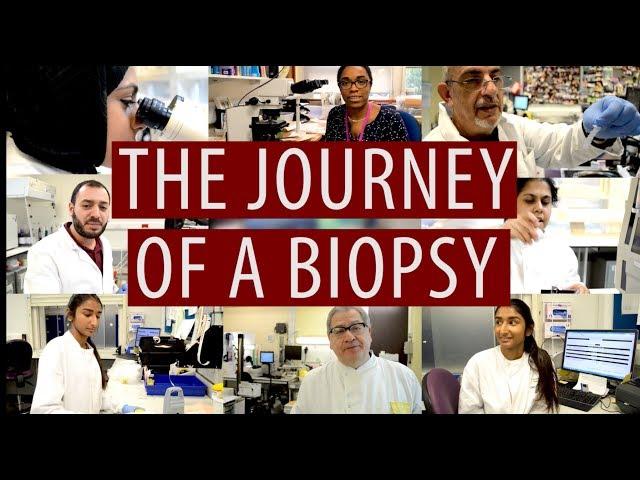 The journey of a biopsy #DiscoverPathology