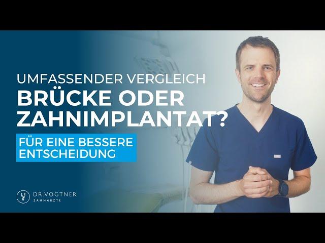 Brücke oder Zahnimplantat? Ein umfassender Vergleich für eine bessere Entscheidung!