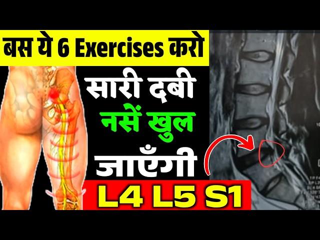 साइटिका,L4 L5 S1 नस दबने का इलाज|L4 L5 S1 Disc Bulge Exercises|Sciatica Pain Relief Exercises