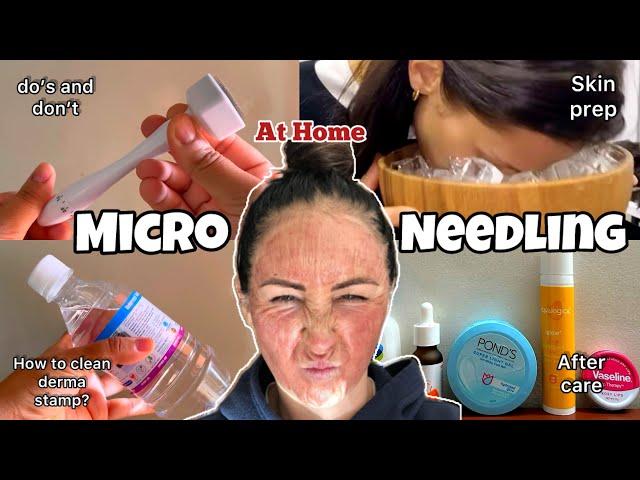 How to Use DERMA STAMP At Home| How to clean derma stamp ? | Skin prep & After care 