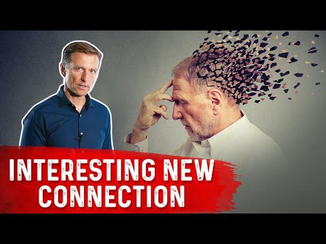 What to do for Alzheimer's Disease if Nothing is Working? – The Perfect Treatment by Dr.Berg