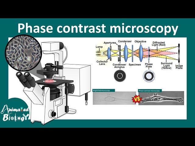 Phase contrast microscopy | Working principle of phase contrast microscope