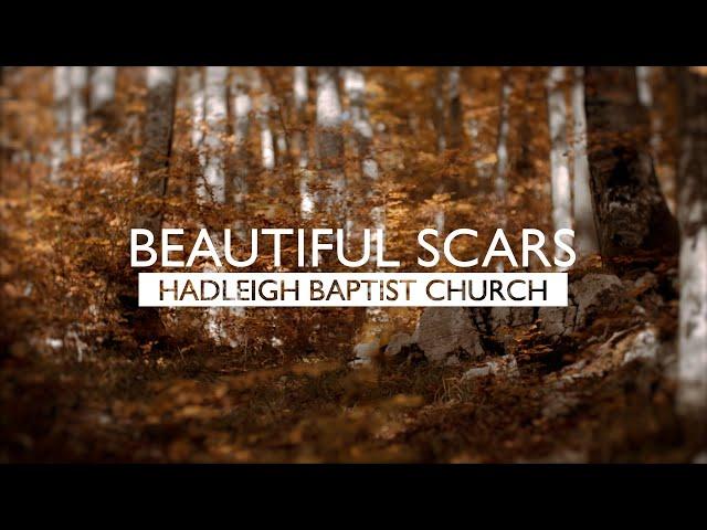 Beautiful Scars | LYRIC VIDEO