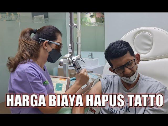 BERAPA BIAYA HAPUS TATTO ... ??