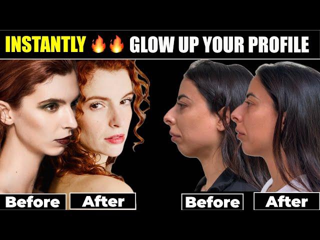 Facial Balancing with Chin Fillers- GAME CHANGING!- Instant Profile Glow Up!