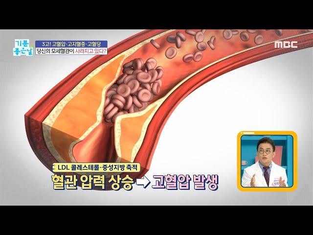 [HEALTHY] The reason why capillaries disappear., 기분 좋은 날 211013