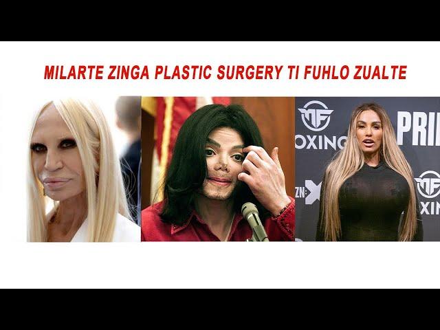 Celebrity zinga  Plastic Surgery ti fuhlo zualte