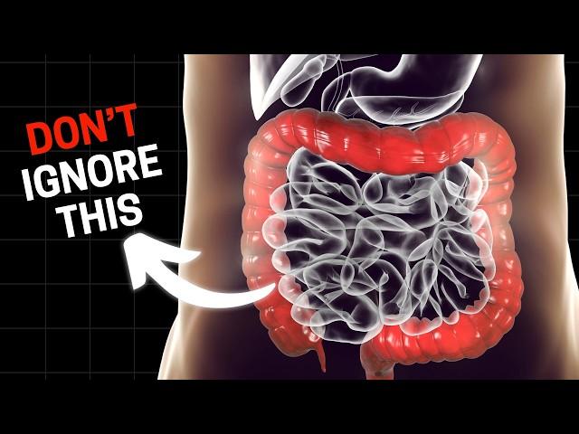 10 Leaky Gut Signs You Should Never Ignore