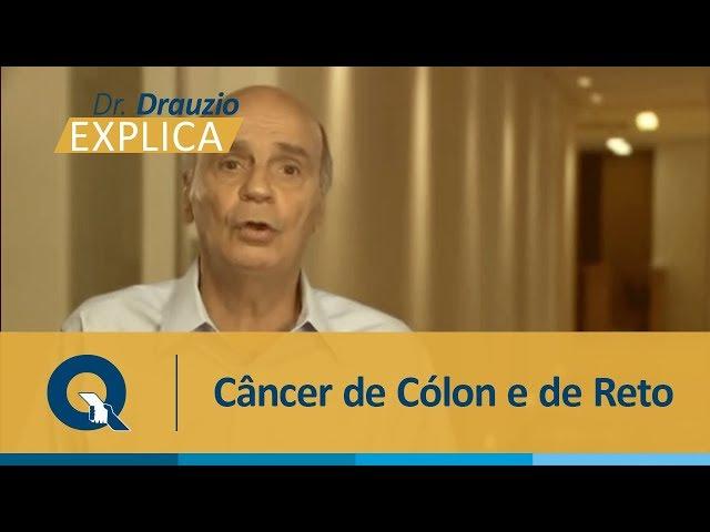 Dr. Drauzio Varella explica quem tem mais risco de desenvolver câncer de cólon e de reto.