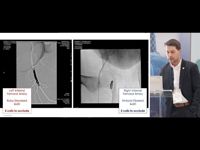 EMBOLD™ Detachable Coil System Pre-Clinical Comparative Study