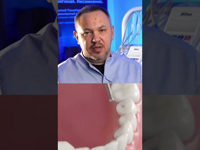 Концепция TissueCare | Имплантаты Ankylos | Dentsply Sirona 