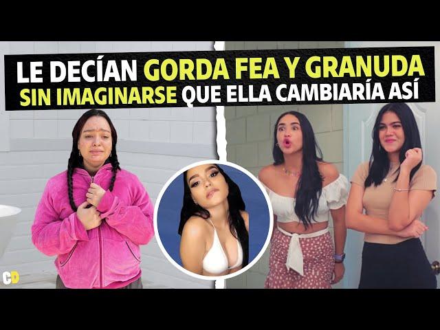 Le decían gorda fea y granuda sin imaginarse que ella cambiaría así.