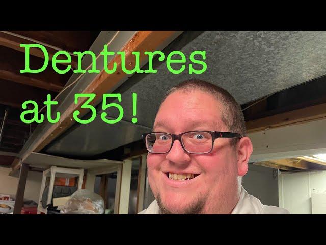 Getting dentures at 35. My story before extraction & Immediate dentures