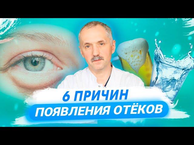 Почему появляются отёки? Основные причины, диагностика, рекомендации / Доктор Виктор