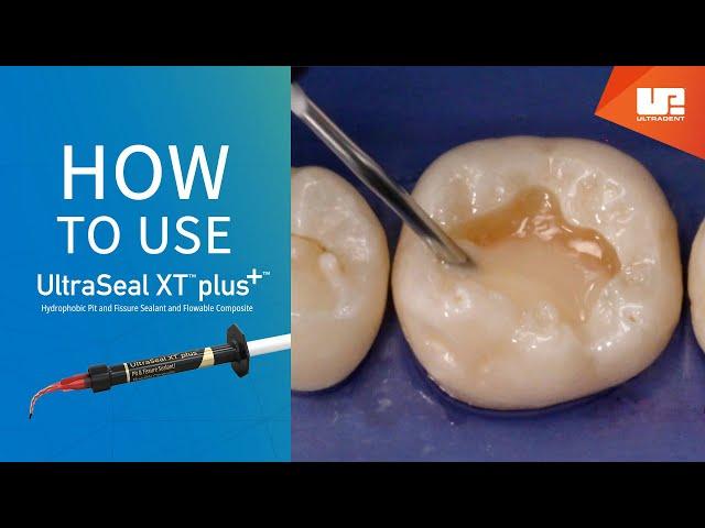 How to use UltraSeal XT™ plus sealant